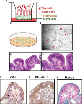 Early host immune responses in a human organoid-derived gallbladder monolayer to Salmonella Typhi strains from patients with acute and chronic infections: a comparative analysis